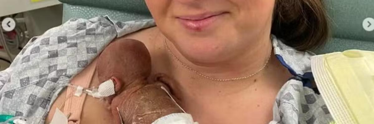 A história inspiradora de Nash, o bebê mais prematuro do mundo